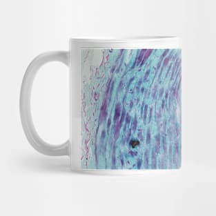 Saphenous vein, light micrograph (C023/7530) Mug